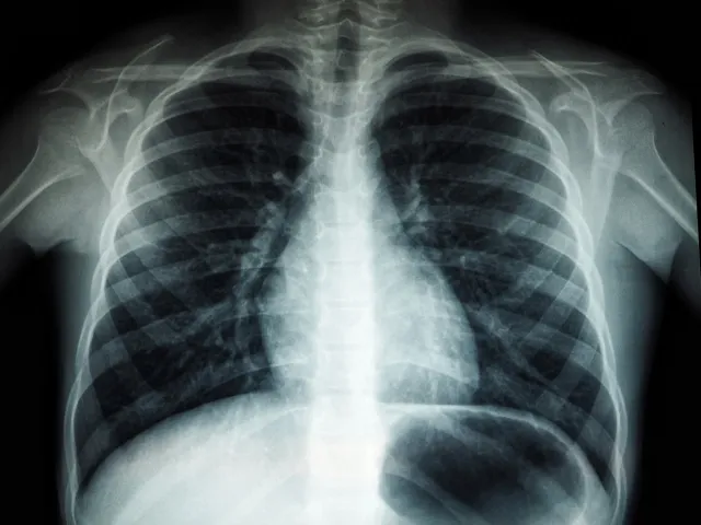 x-ray of a person's chest